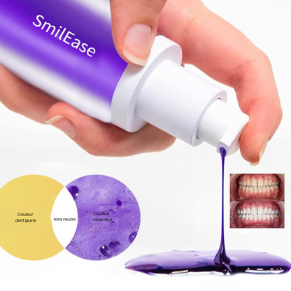 White Smille Pro Blanchisseur Kit